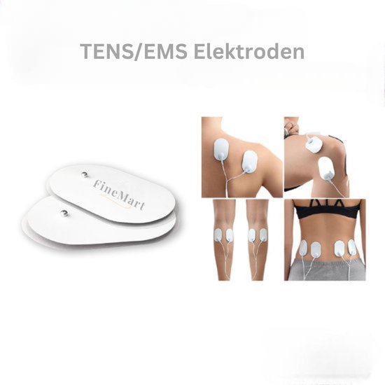FineMart 10 Paren 20 Stuks Elektroden